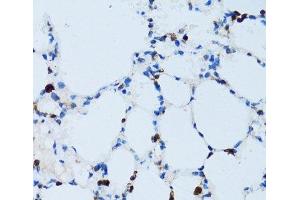 Immunohistochemistry of paraffin-embedded Mouse lung using SPN Polyclonal Antibody at dilution of 1:100 (40x lens).
