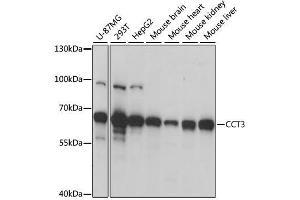 Western blot analysis of extracts of various cell lines, using CCT3 antibody. (CCT3 anticorps  (AA 1-300))