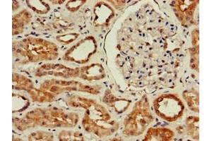 Immunohistochemistry of paraffin-embedded human kidney tissue using ABIN7175855 at dilution of 1:100 (WISP3 anticorps  (AA 201-372))