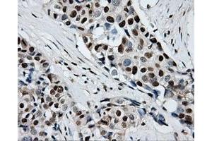 Image no. 4 for anti-Replication Protein A2, 32kDa (RPA2) antibody (ABIN1500733)