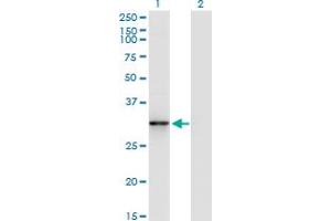 Western Blot analysis of CDK5 expression in transfected 293T cell line by CDK5 monoclonal antibody (M01A), clone 1A2.