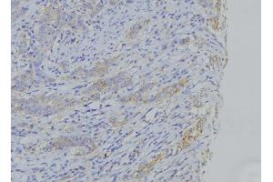 ABIN6273503 at 1/100 staining Human gastric tissue by IHC-P. (Cytochrome b anticorps  (N-Term))