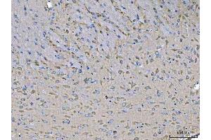 IHC analysis of MST3/STK24 using anti-MST3/STK24 antibody (ABIN7599389).
