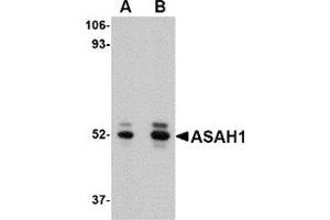 Western blot analysis of ASAH1 in mouse heart tissue lysate with ASAH1 antibody at (A) 1 and (B) 2 μg/ml. (ASAH1 anticorps  (C-Term))