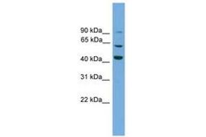 Image no. 1 for anti-Taxilin gamma (TXLNG) (AA 51-100) antibody (ABIN6744647) (Taxilin gamma (TXLNG) (AA 51-100) anticorps)