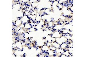 Immunohistochemistry of paraffin embedded mouse pneumonia using IL-2 Receptor alpha (ABIN7074349) at dilution of 1: 500 (400x lens)