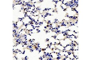 Immunohistochemistry of paraffin embedded mouse pneumonia using IL-2 Receptor alpha (ABIN7074349) at dilution of 1: 500 (400x lens) (CD25 anticorps)