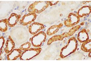 Immunohistochemistry of paraffin-embedded Human kidney using S100A6 Polycloanl Antibody at dilution of 1:150 (S100A6 anticorps)