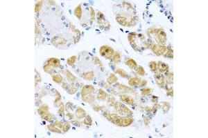 Immunohistochemistry of paraffin-embedded human stomach using RPS2 antibody.