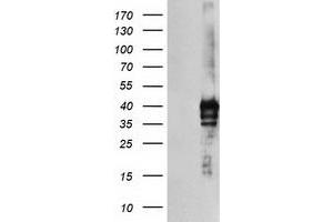 HEK293T cells were transfected with the pCMV6-ENTRY control (Left lane) or pCMV6-ENTRY SDS (Right lane) cDNA for 48 hrs and lysed. (serine Dehydratase anticorps)