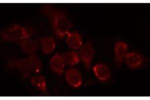 ABIN6274639 staining HuvEc by IF/ICC.