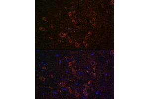 Immunofluorescence analysis of rat brain using SLC5 Rabbit pAb (ABIN7267643) at dilution of 1:100 (40x lens). (ChT anticorps  (AA 421-580))