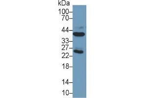 Mouse Capture antibody from the kit in WB with Positive Control: Sample Human Liver lysate;. (ARG Kit ELISA)