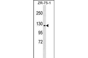 ERN1 Antibody (C-term) (ABIN1537620 and ABIN2849317) western blot analysis in ZR-75-1 cell line lysates (35 μg/lane). (ERN1 anticorps  (C-Term))