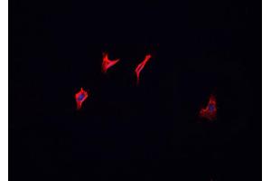 ABIN6266695 staining MCF-7 cells by IF/ICC. (HGS anticorps  (Internal Region))