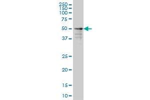 ZNF213 monoclonal antibody (M01), clone 5D7 Western Blot analysis of ZNF213 expression in A-431 . (ZNF213 anticorps  (AA 133-242))