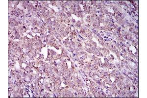 Immunohistochemistry (IHC) image for anti-Integrin Alpha2b (CD41) (AA 45-149) antibody (ABIN1844101)