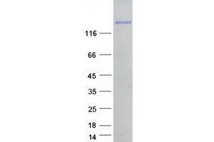 Validation with Western Blot