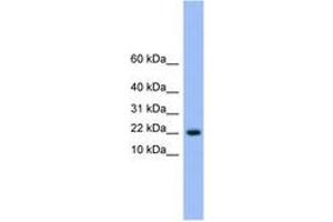 Image no. 1 for anti-NTF2-Related Export Protein 1 (NXT1) (AA 41-90) antibody (ABIN6745580) (NXT1 anticorps  (AA 41-90))