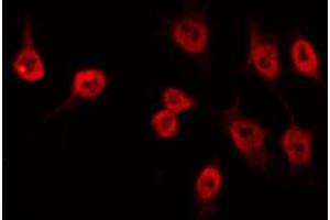 ABIN6274533 staining Hela by IF/ICC. (HMG20B anticorps  (N-Term))