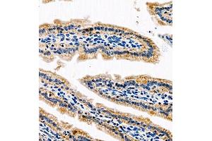Immunohistochemistry of paraffin embedded mouse small intestine using AnnexinA13 (ABIN7073061) at dilution of 1:1500 (400x lens) (Annexin A13 anticorps)