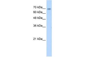 anti-Zinc Finger Protein 264 (ZNF264) (C-Term) antibody
