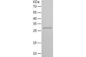 Western Blotting (WB) image for SMAD Family Member 4 (SMAD4) (AA 13-227) protein (His tag) (ABIN7125119)