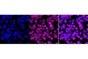 Immunocytochemical staining of HAP-1 cells with MBD1 antibody (ABIN7799385), 1:1,000).