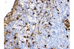 Immunohistochemistry (Paraffin-embedded Sections) (IHC (p)) image for anti-S100 Calcium Binding Protein A9 (S100A9) (AA 2-114) antibody (ABIN3043321)