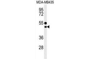 Western Blotting (WB) image for anti-CD1e (CD1e) antibody (ABIN3004387) (CD1e anticorps)