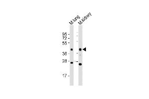 All lanes : Anti-Epcam Antibody (C-term) at 1:2000 dilution Lane 1: mouse lung lysates Lane 2: mouse kidney lysates Lysates/proteins at 20 μg per lane.