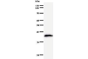 Western Blotting (WB) image for anti-Leucine Zipper, Down-Regulated in Cancer 1 (LDOC1) antibody (ABIN932190)