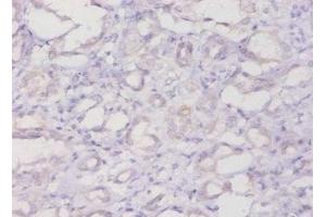 Immunohistochemistry of paraffin-embedded human kidney tissue using ABIN7152720 at dilution of 1:20 (FTL anticorps  (AA 2-175))
