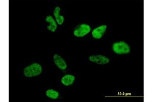 Immunofluorescence of purified MaxPab antibody to WBP11 on HeLa cell.