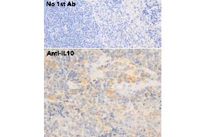 Immunohistochemistry (IHC) image for anti-Interleukin 10 (IL10) antibody (ABIN6254177) (IL-10 anticorps)