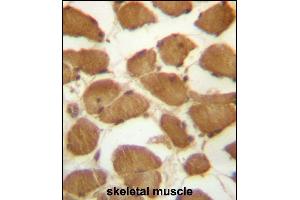 CDKN1B Antibody (C-term) (ABIN657225 and ABIN2846327) immunohistochemistry analysis in formalin fixed and paraffin embedded human skeletal muscle followed by peroxidase conjugation of the secondary antibody and DAB staining.