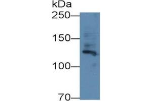 Rabbit Capture antibody from the kit in WB with Positive Control: Human Placenta lysate. (Fibrillin 1 Kit CLIA)