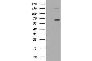 Western Blotting (WB) image for anti-Pyruvate Kinase, Liver and RBC (PKLR) antibody (ABIN1500245) (PKLR anticorps)