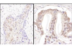 Immunohistochemistry (IHC) image for anti-Proteasome (Prosome, Macropain) 26S Subunit, Non-ATPase, 3 (PSMD3) (AA 1-50) antibody (ABIN7454966)