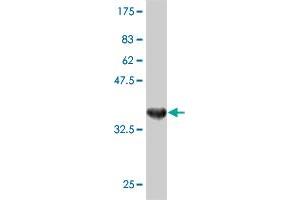 Western Blot detection against Immunogen (37. (DSTYK anticorps  (AA 80-189))