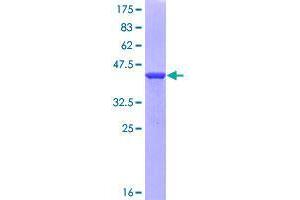 Image no. 1 for Sperm Antigen with Calponin Homology and Coiled-Coil Domains 1 (SPECC1) (AA 527-636) protein (GST tag) (ABIN1351051)
