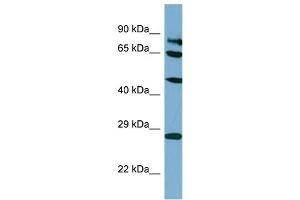 Host:  Rabbit  Target Name:  SV2B  Sample Type:  HT1080 Whole Cell lysates  Antibody Dilution:  1. (SV2B anticorps  (C-Term))