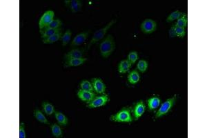 Immunofluorescent analysis of HepG2 cells using ABIN7142292 at dilution of 1:100 and Alexa Fluor 488-congugated AffiniPure Goat Anti-Rabbit IgG(H+L)