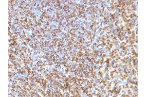Formalin-fixed, paraffin-embedded human Spleen stained with Galectin-13 Monoclonal Antibody (PP13/1161). (LGALS13 anticorps  (AA 23-134))