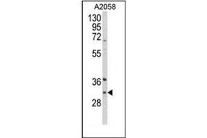 Western blot analysis of ING5 Antibody (Center) in A2058 cell line lysates (35ug/lane).