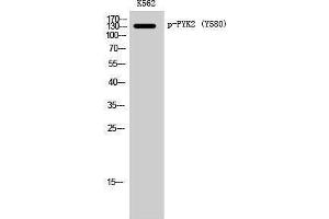 Western Blotting (WB) image for anti-PTK2B Protein tyrosine Kinase 2 beta (PTK2B) (pTyr580) antibody (ABIN3182496)