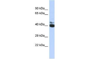 Western Blotting (WB) image for anti-FERM Domain Containing 3 (FRMD3) (C-Term) antibody (ABIN2774119) (FRMD3 anticorps  (C-Term))
