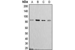 Western blot analysis of Cortactin expression in MCF7 (A), C6 (B), A431 (C), HeLa (D) whole cell lysates.