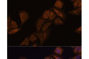 Immunofluorescence analysis of U-2 OS cells using ATXN2 Polyclonal Antibody at dilution of 1:100.