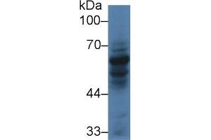 Detection of CARD9 in Human HL60 cell lysate using Polyclonal Antibody to Caspase Recruitment Domain Family, Member 9 (CARD9) (CARD9 anticorps  (AA 26-283))